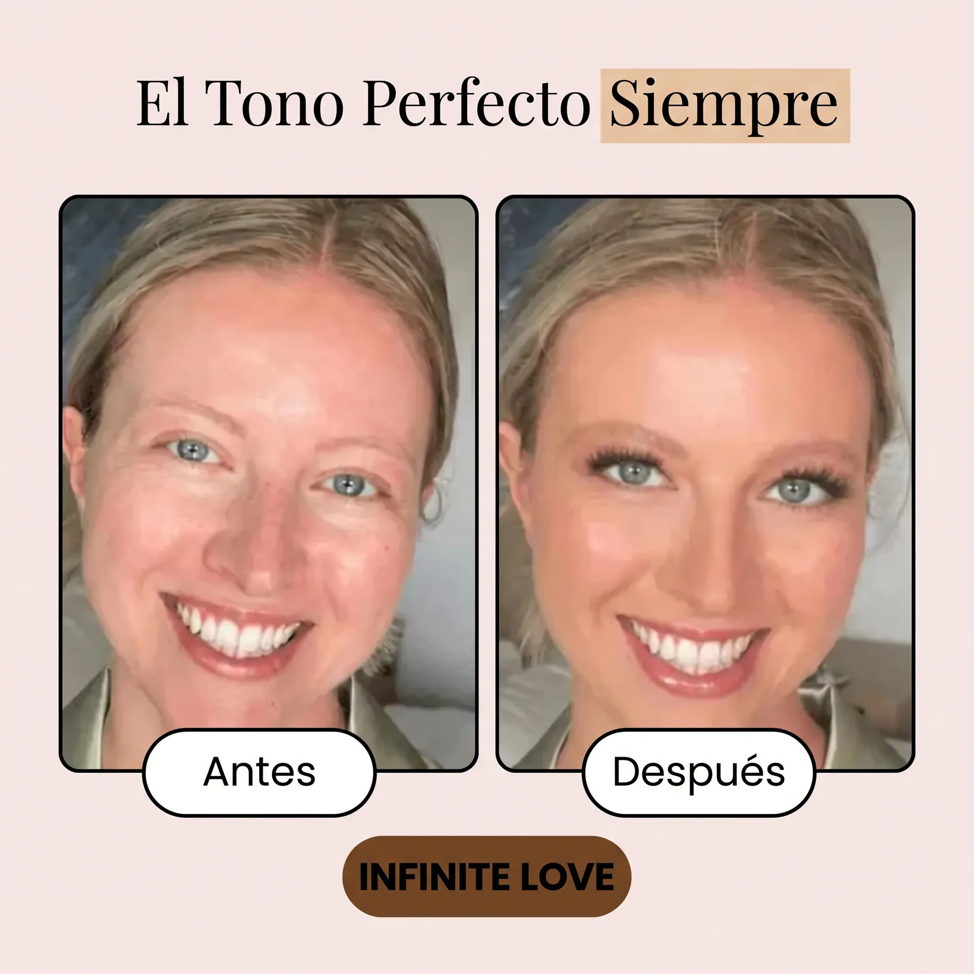 Antes y Después - Resultado Real - INFINITE LOVE