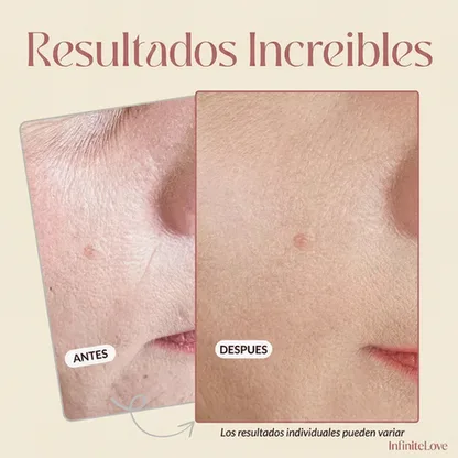 Primer Difuminador Antiarrugas – Efecto Piel Lisa Instantáneo