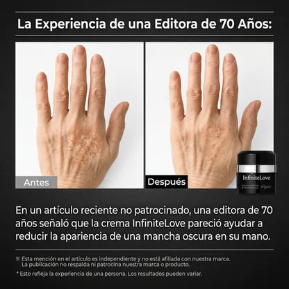 Crema Despigmentante Intensiva – Reduce Manchas y Unifica el Tono