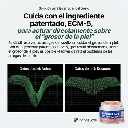Crema Tensora de Cuello ECM – Efecto Lifting y Reafirmante Intensivo