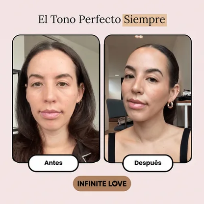 Antes y Después - Resultado Real #3 - INFINITE LOVE