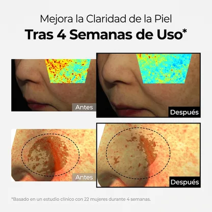Crema Despigmentante Intensiva – Reduce Manchas y Unifica el Tono