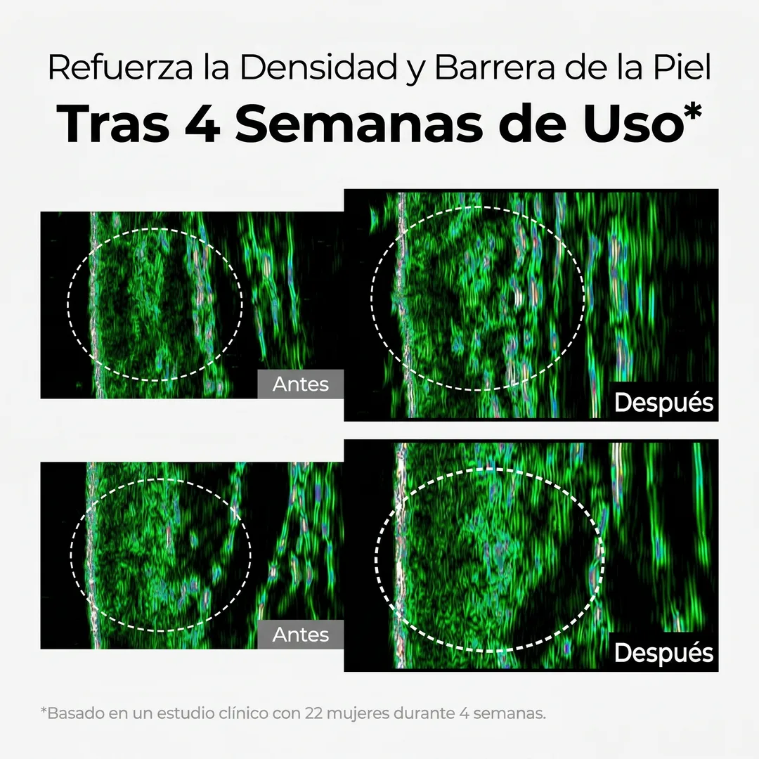 Crema Despigmentante Intensiva – Reduce Manchas y Unifica el Tono