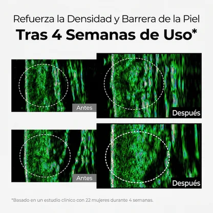 Crema Despigmentante Intensiva – Reduce Manchas y Unifica el Tono