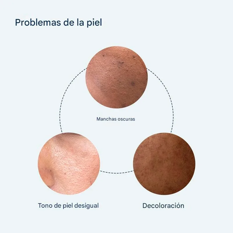 Sérum puntos negros