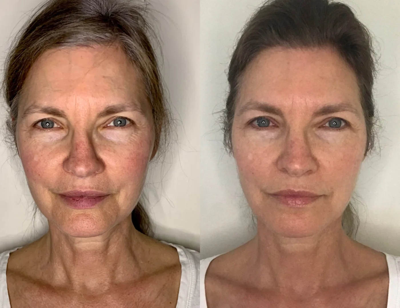 Antes y después Sara A.