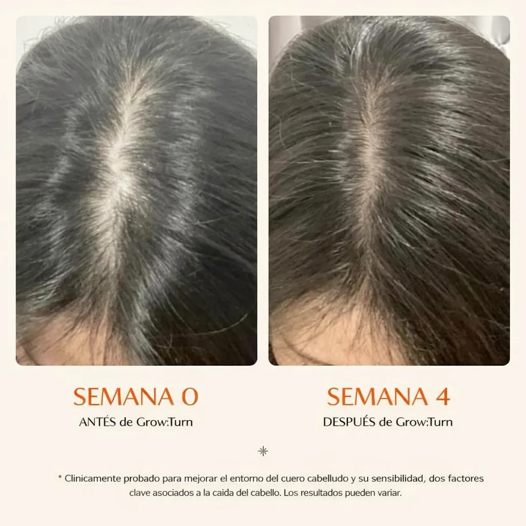 Suero Estimulador de Crecimiento Capilar con Cepillo Masajeador Integrado para Frenar la Caída y Engrosar el Cabello