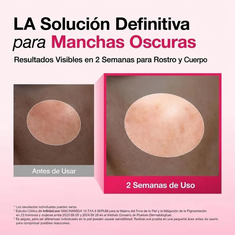Sérum Niacinamida 10% + Ácido Tranexámico 4% Antimanchas Luminosidad K-Beauty 30ml