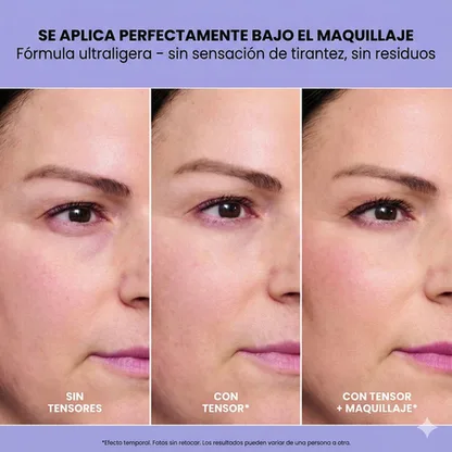 InfiniteLift – Gel tensor para bolsas y líneas de expresión