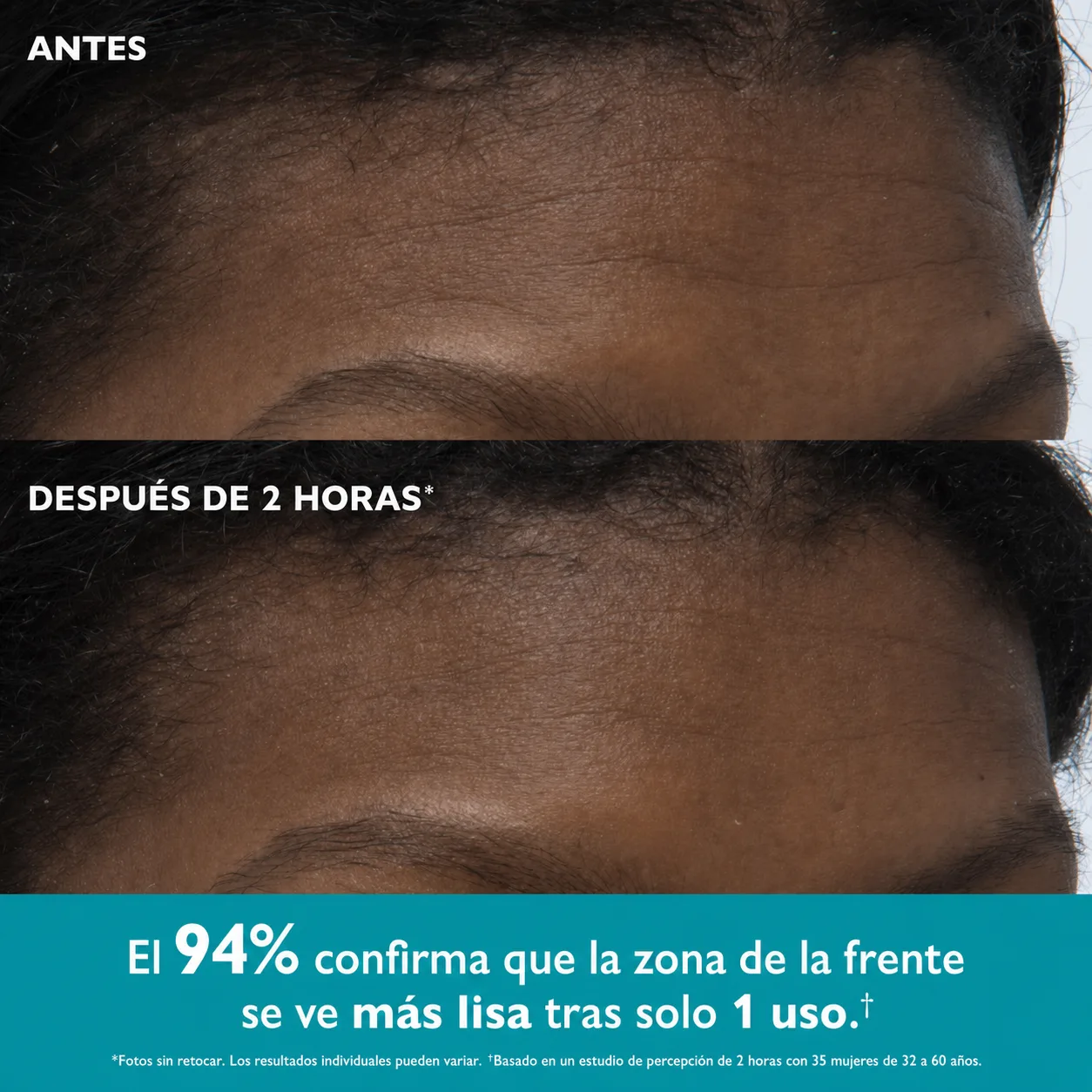 Comparación visual de la zona de la frente incluida en la galería