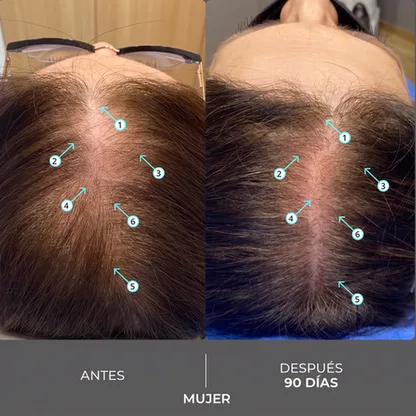 Antes y Después Mujer 90 Días