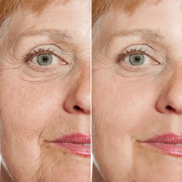 Suero Facial Rejuvenecedor