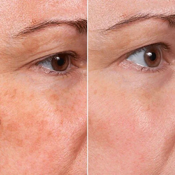 Suero Facial Rejuvenecedor