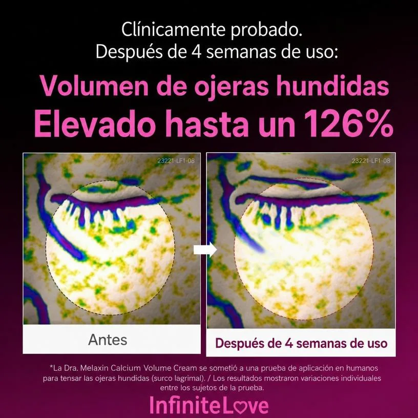 Información visual del producto Calcio CX