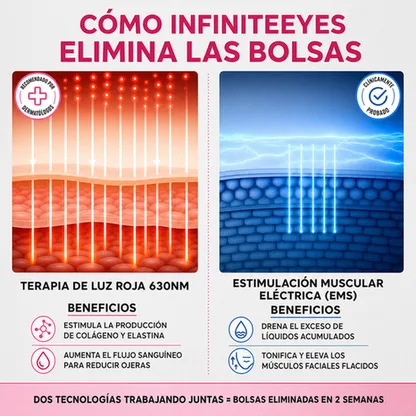 InfiniteEyes® — Terapia de Luz Roja + EMS para Eliminar Bolsas