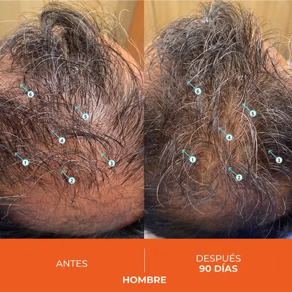 Antes y Después Hombre 90 Días 6 flechas
