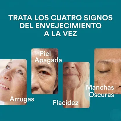 Suero Facial 4 en 1 con Vitamina C y Péptidos para Arrugas, Flacidez y Manchas