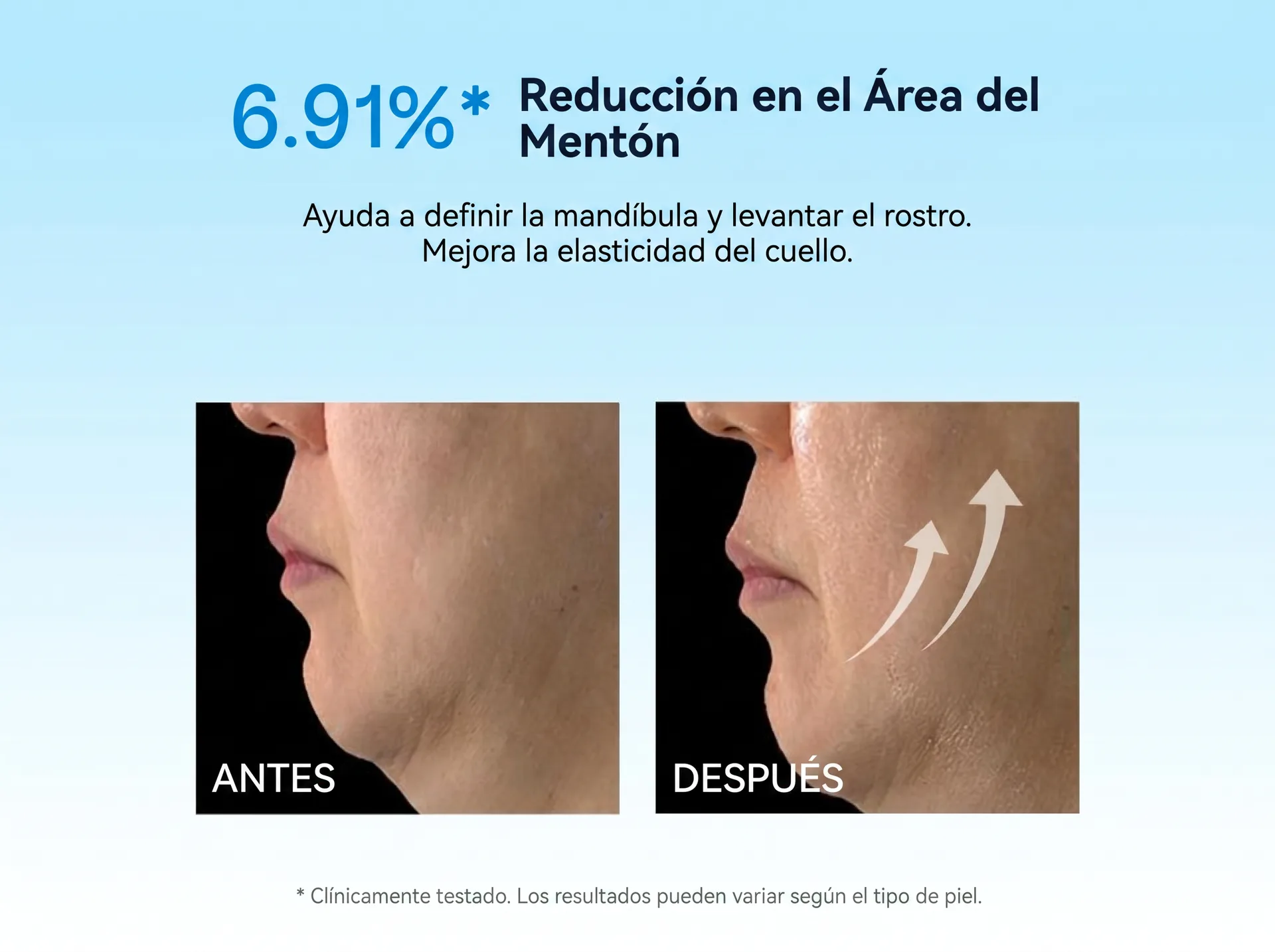 Resultados Antes y Después - Reducción del Área del Mentón