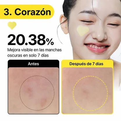 Parches Sérum Antimanchas — Glutatión 7 Triple Acción 30 uds