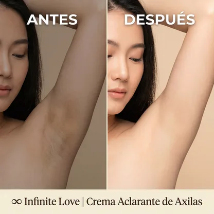 Crema Aclarante para Axilas Hidratación Profunda y Corrección de Manchas Oscuras