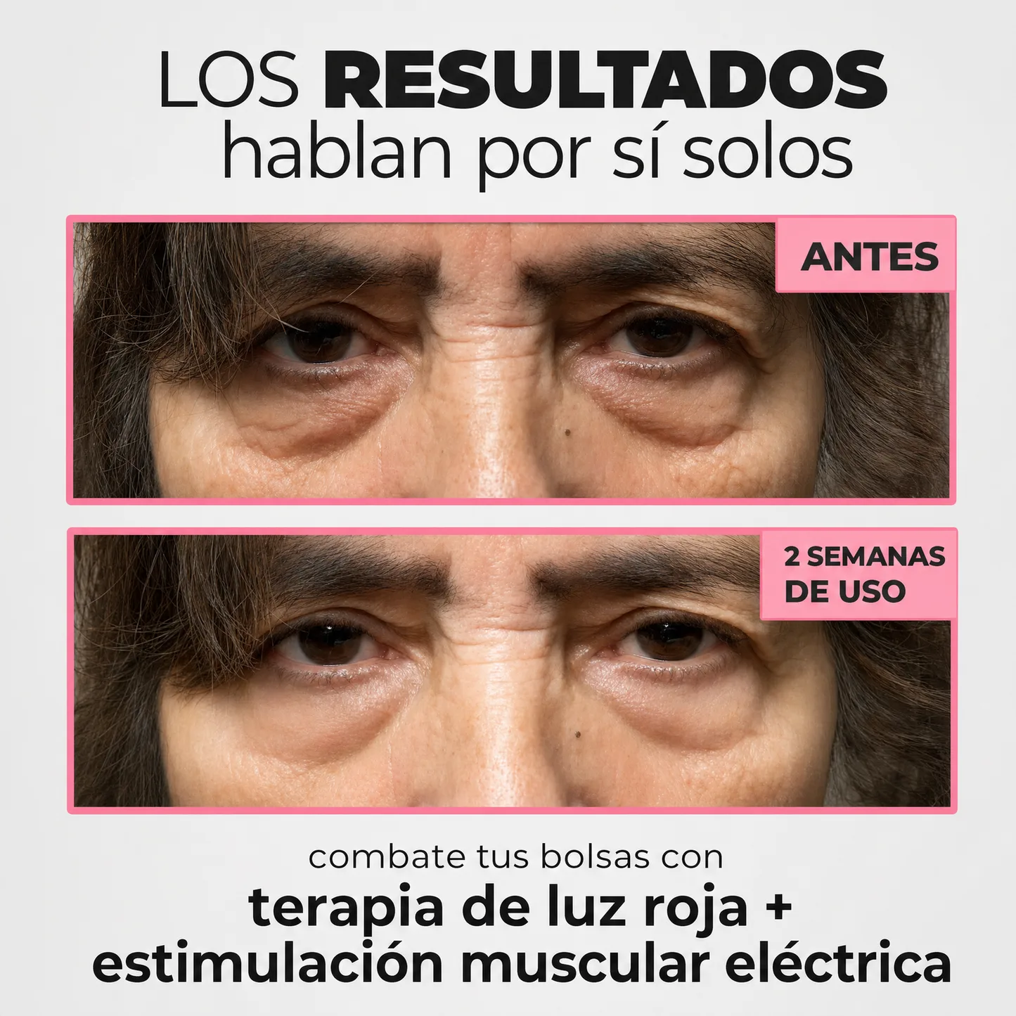 InfiniteEyes® — Terapia de Luz Roja + EMS para Eliminar Bolsas