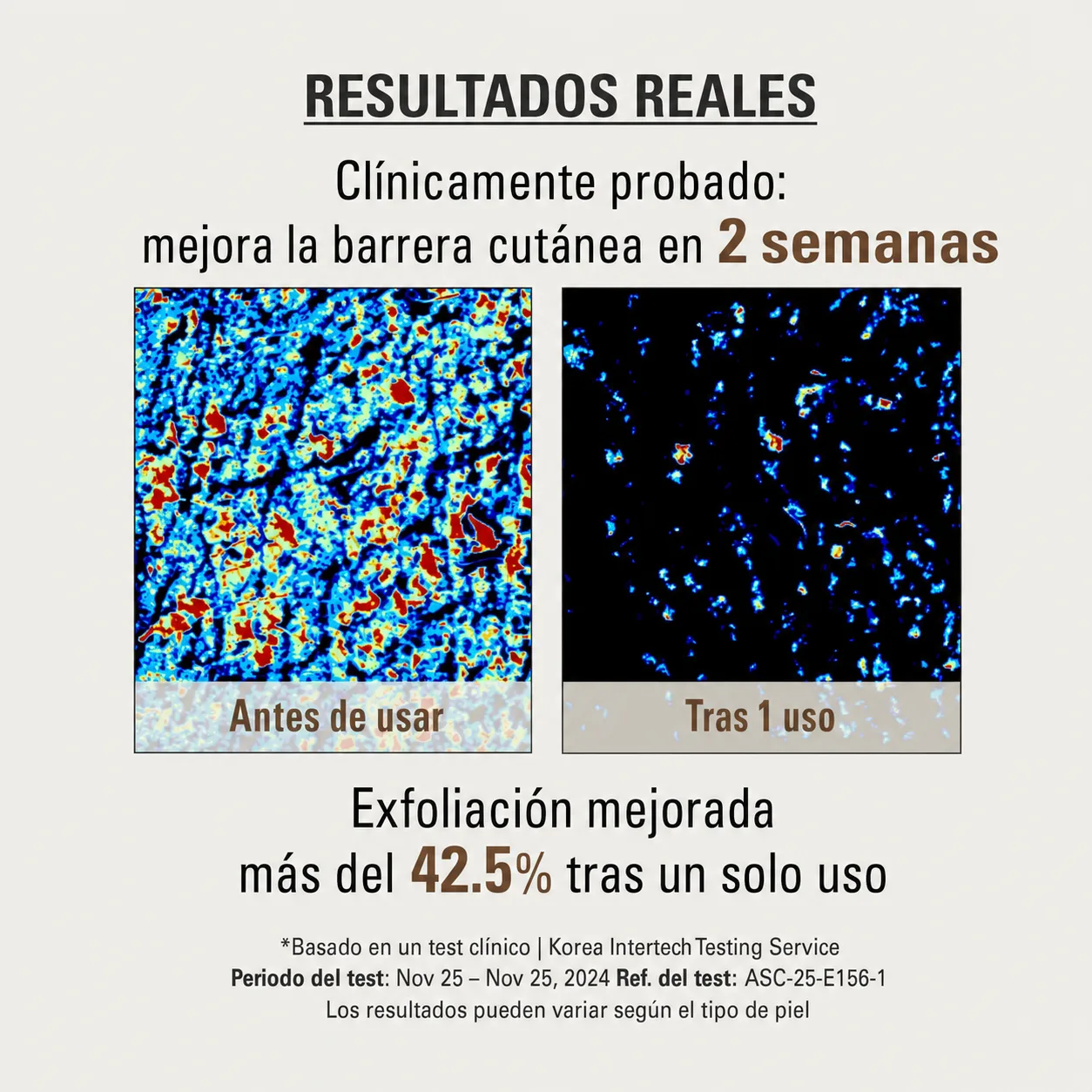 Resultados Reales: Mejora de la barrera cutánea