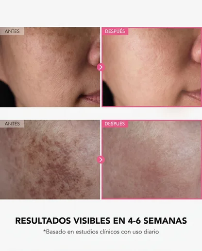 InfiniteBright - Crema Iluminadora Avanzada con Arbutina