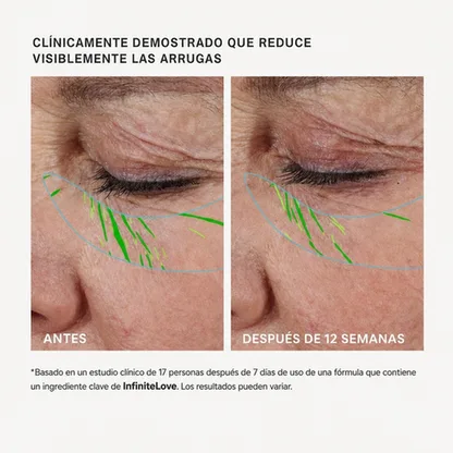 InfiniteLove BioLift — Sérum Reafirmante con Péptidos y Ceramidas 30 ml