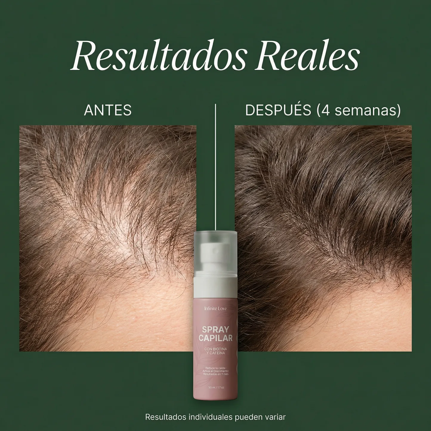 Spray Capilar Anticaída con Biotina y Cafeína – Fortalece y Reduce la Caída