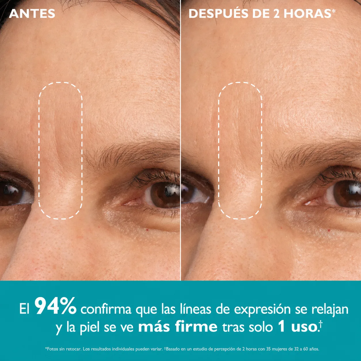 Comparación visual de la zona de la frente incluida en la galería del producto