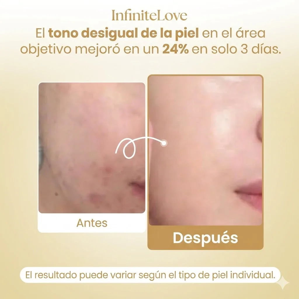 GoldMask — Mascarilla Nocturna Peel-Off de Cúrcuma y Ácido Kójico