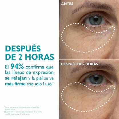 Comparación visual del contorno de ojos incluida en la galería