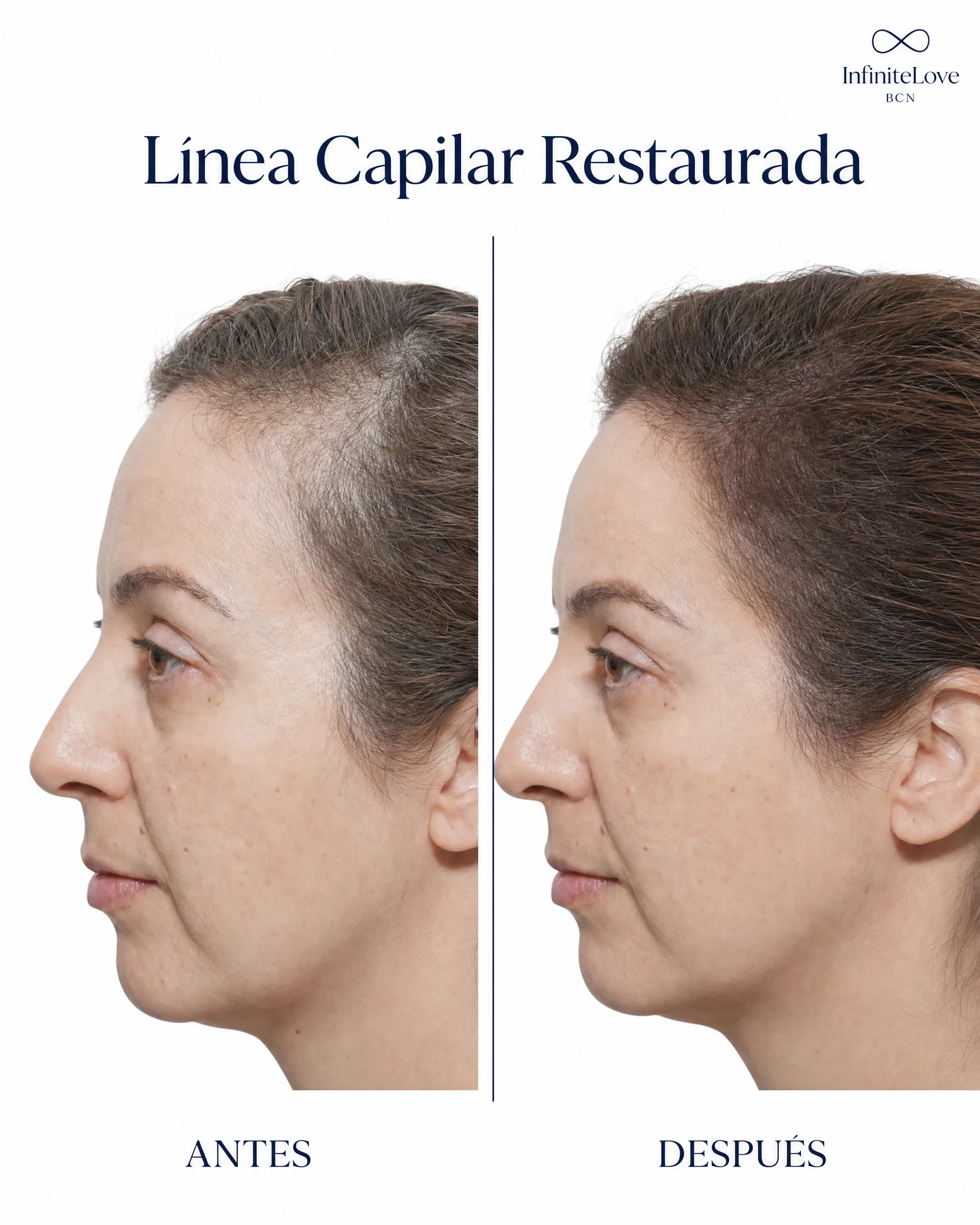 Antes y Después Línea Capilar