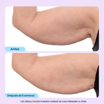 Crema Reafirmante y Tonificante para Brazos 7% Complejo ProTight Ashwagandha Anti-Flacidez 100ml