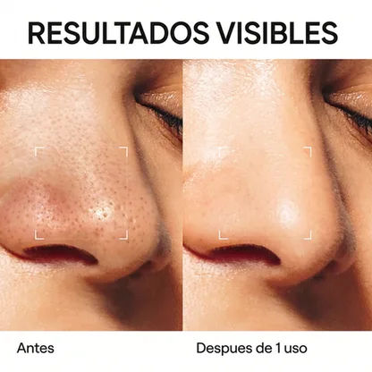 Mascarilla en Barra de Arcilla Volcánica para Puntos Negros